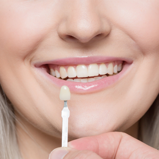 Dental Veneers: Pros and Cons