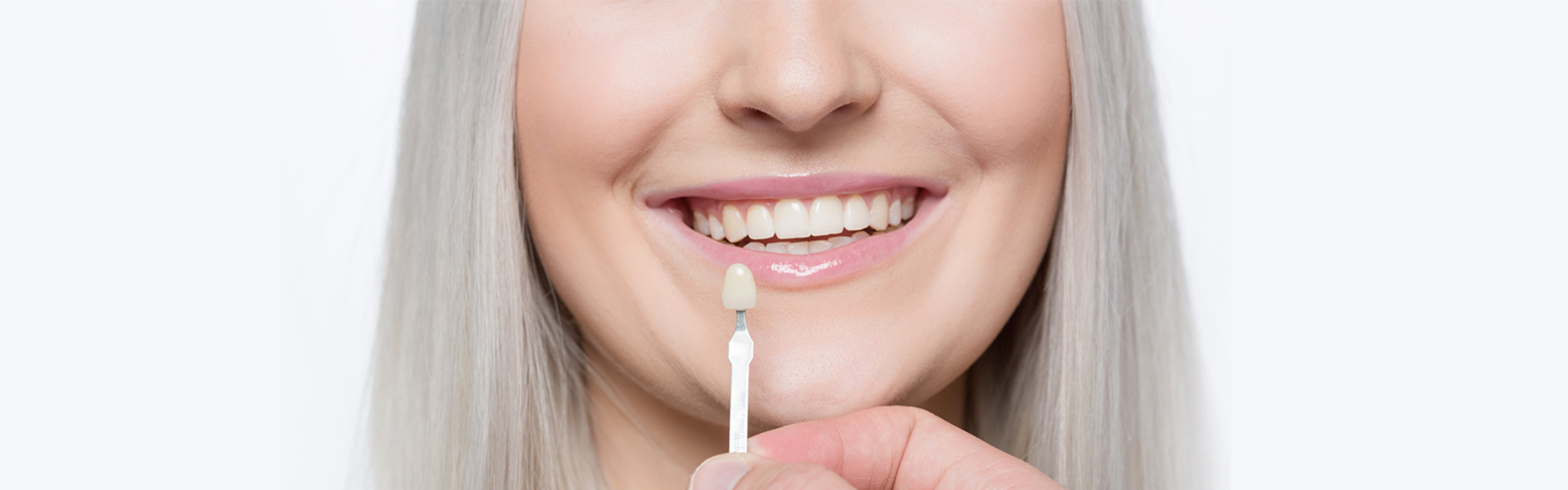 Dental Veneers: Pros and Cons