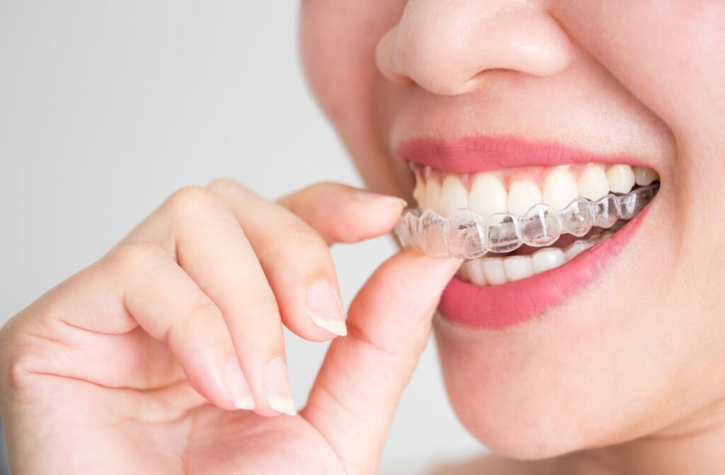 Close-up of a person's mouth as they take out their Invisalign retainer to eat.